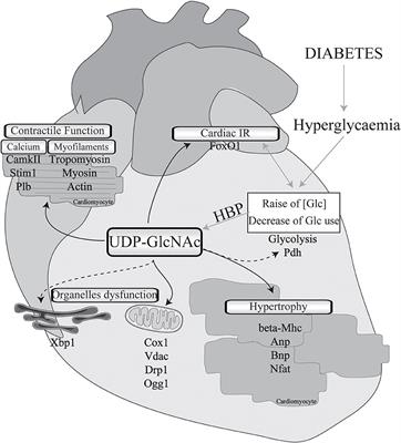 Chronic O-GlcNAcylation and Diabetic Cardiomyopathy: The Bitterness of Glucose